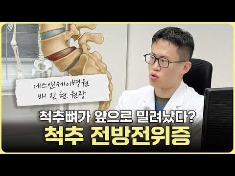 척추뼈가 밀려났다? 허리 통증 원인 ‘척추 전방전위증’ #척추전방전위증 #허리통증 #척추